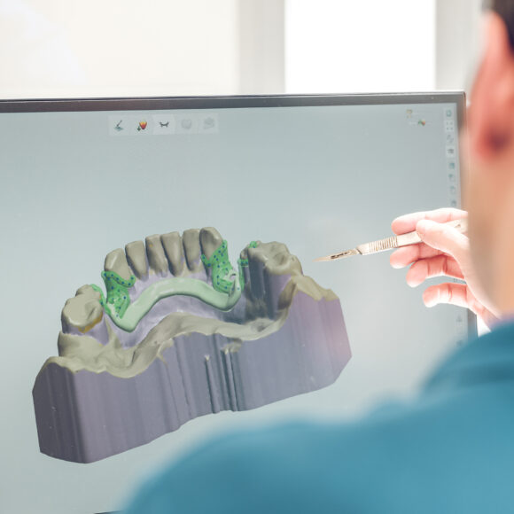 Tecnologia CAD/CAM in Odontoiatria: Rivoluzionare il Sorriso in un Click