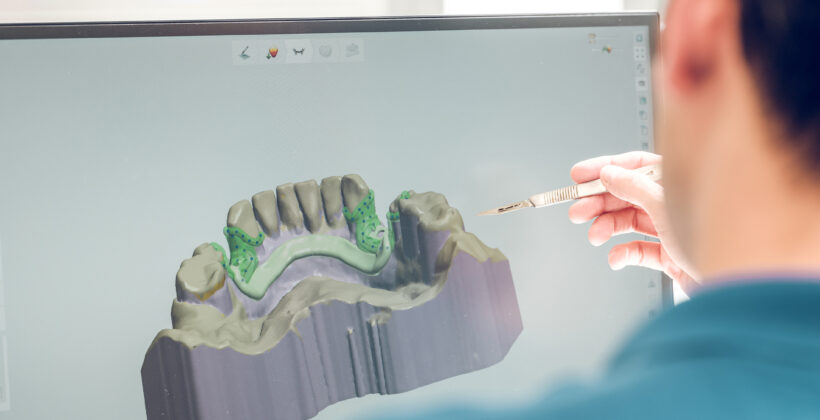 Tecnologia CAD/CAM in Odontoiatria: Rivoluzionare il Sorriso in un Click